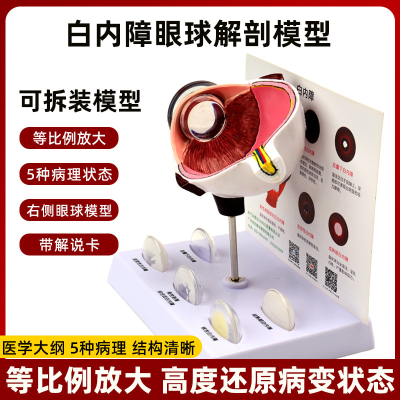 人体仿真眼睛眼球3d结构放大解剖模型白内障病理演示医学教学道具