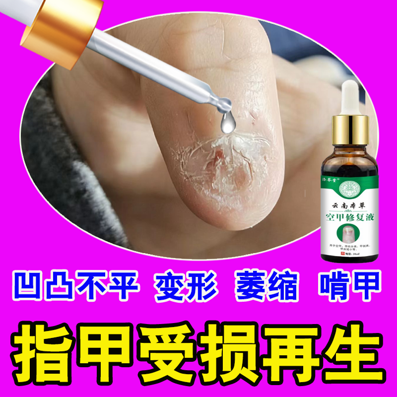 Nail Repair Growth Solution for Nails That Are Uneven, Deformed, and Damaged; Regenerates Nail Beds and Promotes Growth