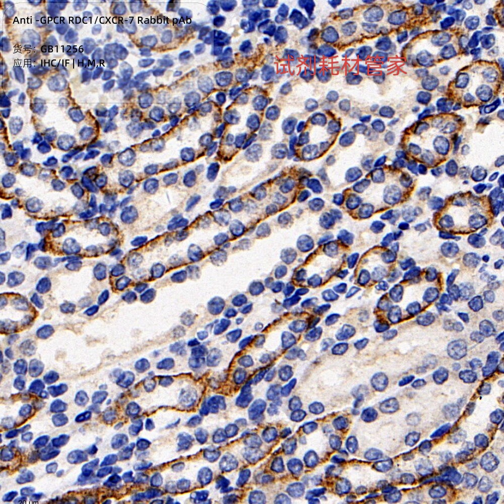 Anti -GPCR RDC1/CXCR-7 Rabbit pAb,抗 GPCR RDC1/CXCR-7 兔 pAb