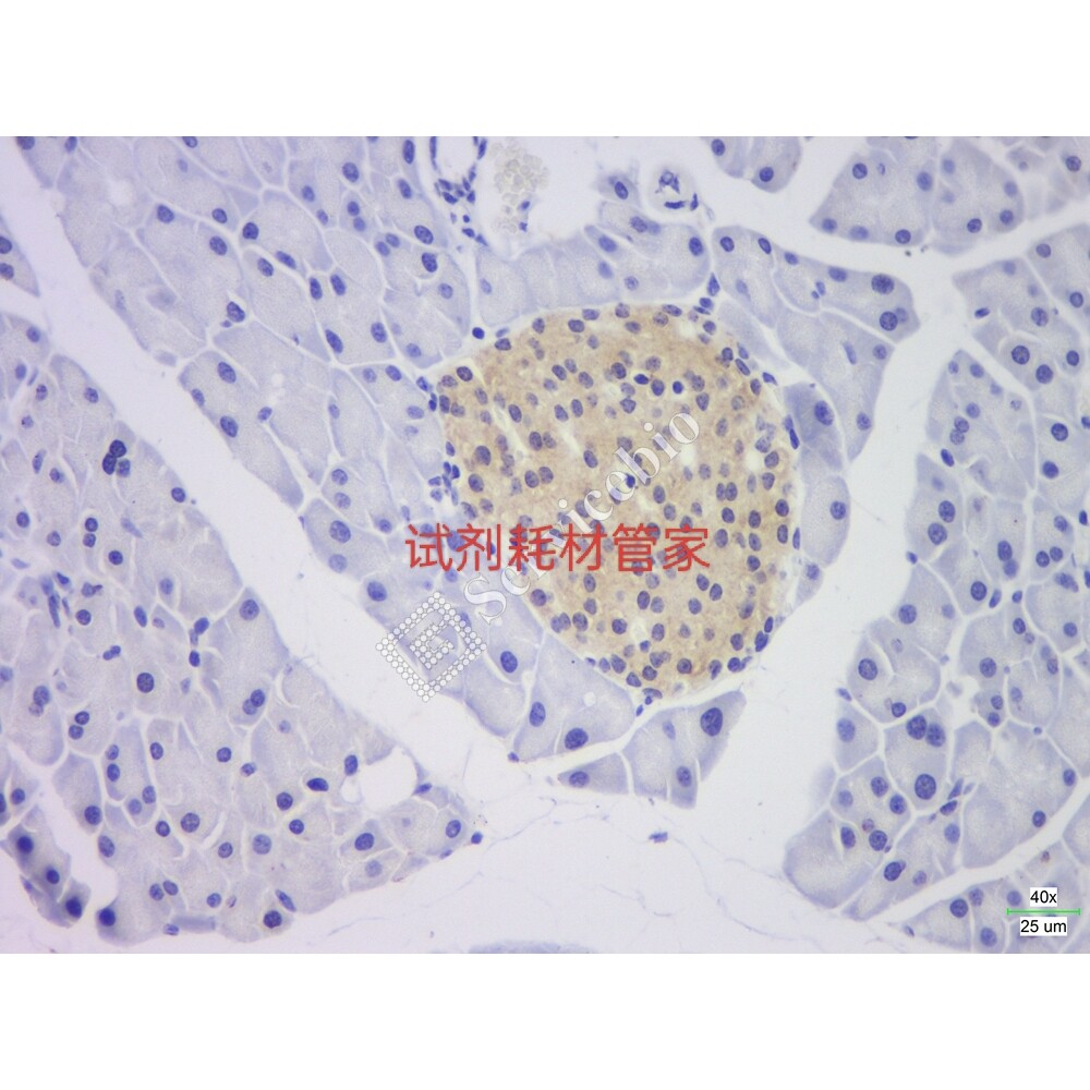 RNASweAMI?原位杂交DAB检测试剂盒 基于碱基互补配对和特定标记