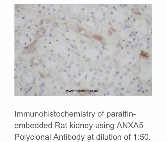 Elabscience?ANXA5多克隆抗体,E-AB-40117,应用于WB与IHC,200&mu;L