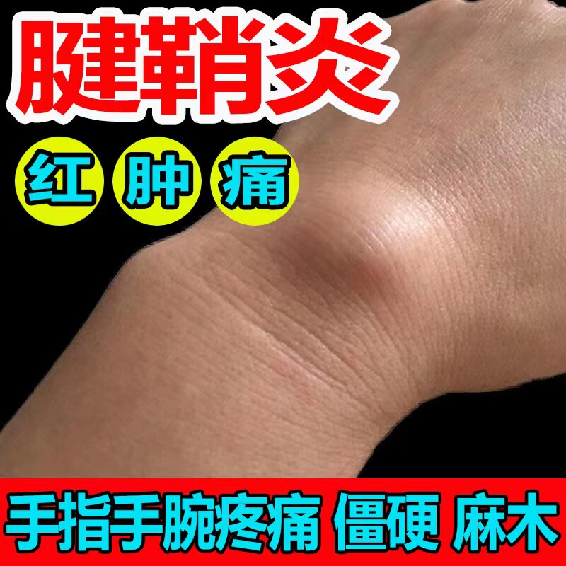 (One box is good) Tendon sheath relaxing ointment special plaster for reducing bulging pain in fingers, wrist joints, flexion and extension pain