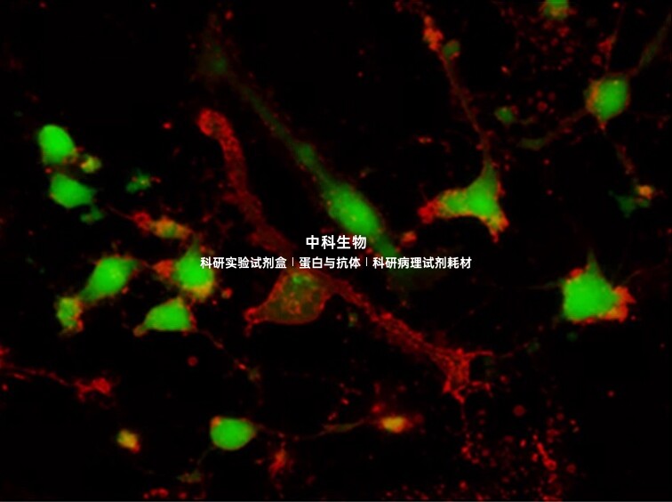 美国AAT钙黄绿素AM,Calcein,AM 活细胞染色标记试剂 检测细胞活力