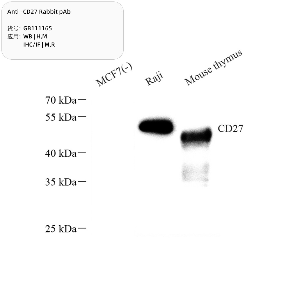 Servicebio抗-CD27兔pAb抗体Anti-CD27 Rabbit pAb,适用WB/IHC/IF