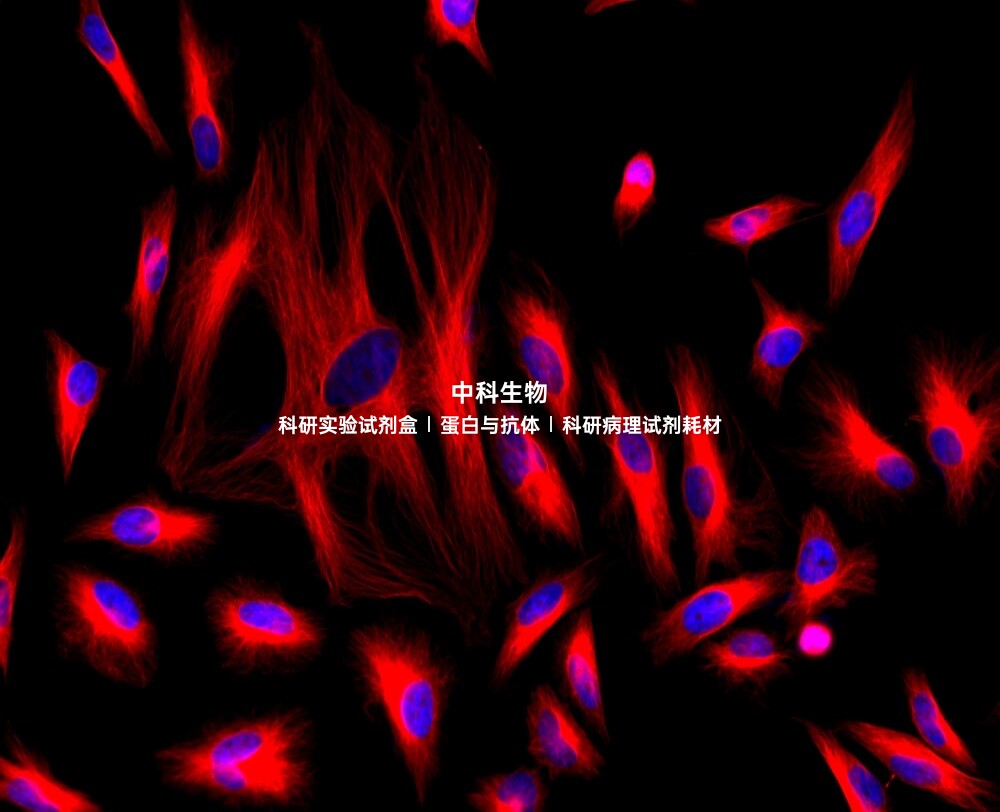 美国AAT iFluor 647琥珀酰亚胺酯 iFluor 647 用于标记蛋白或抗体