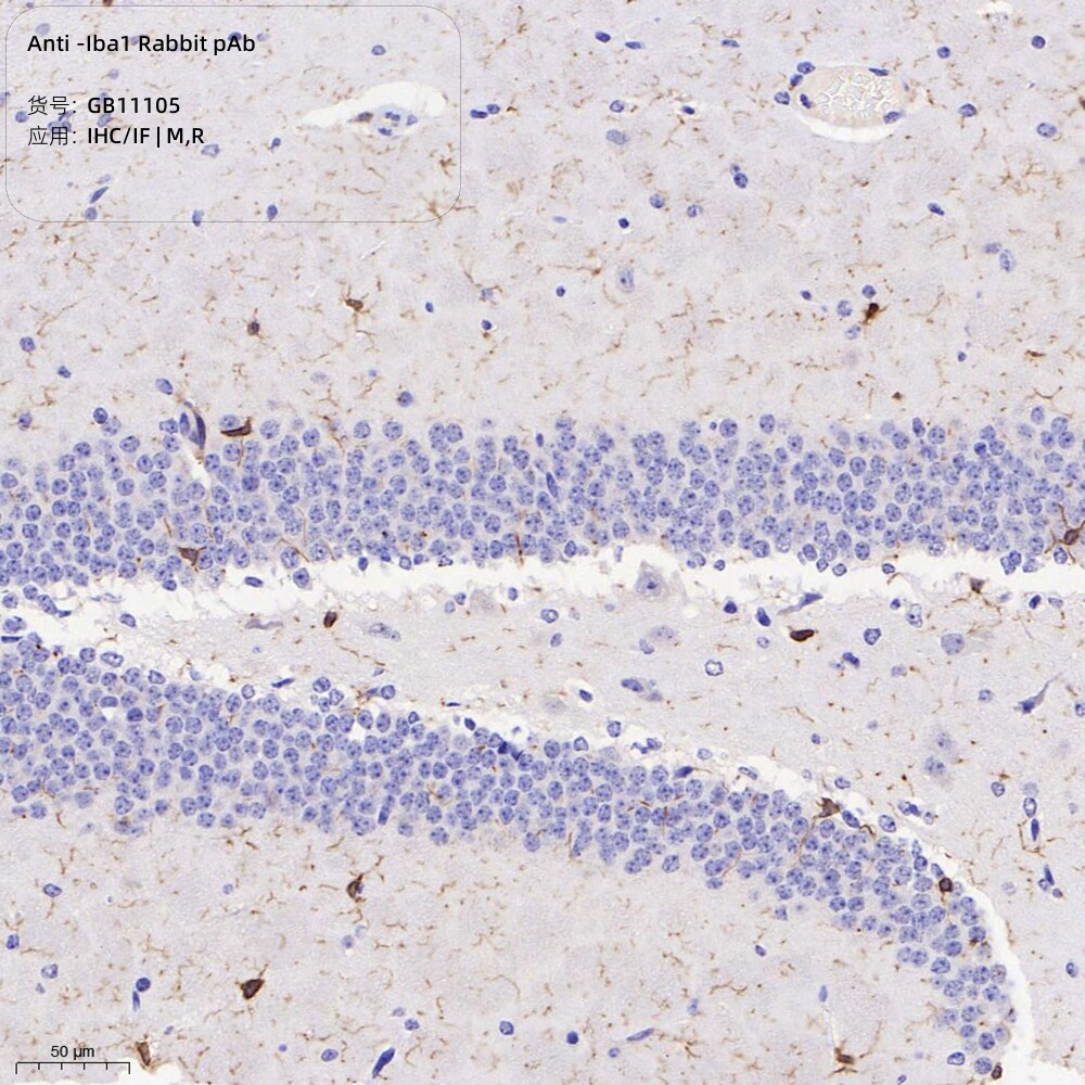 Servicebio抗-Iba1兔pAb抗体,适用IHC/IF,小胶质细胞/推荐抗体M/R