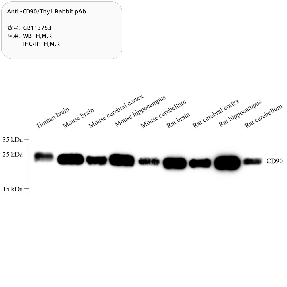 Servicebio抗-CD90/Thy1兔pAbAnti-CD90/Thy1 RabbitpAb,GB113753
