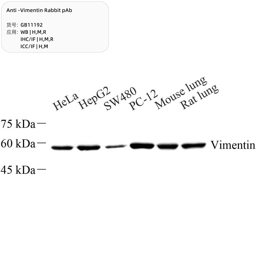 抗维门汀兔pAb抗体,Anti-Vimentin Rabbit pAb,适用WB/IHC/IF/ICC