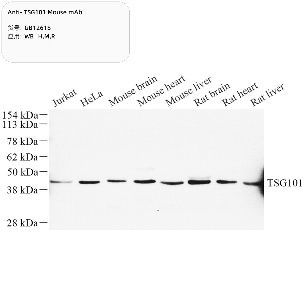 Servicebio抗TSG101小鼠单克隆抗体100&mu;L,适用WB,应用种属H/M/R