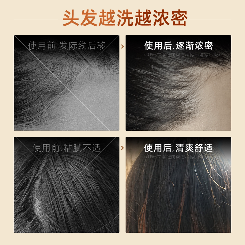 从发根到发梢的精准修复：琴叶生姜颗粒洗发水的防脱技术解析_洗发水_淘宝美妆网