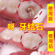 (Whiter teeth are more beautiful) White teeth don’t ask for help. Remove yellowing of teeth and remove calculus smoke stains and tea stains. It is a universal tool for both men and women.