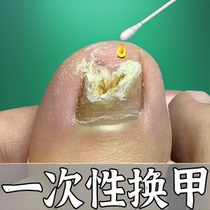 (Watson’s hot sale) One drop of it inhibits bacteria without removing nails removes 99% of gray potassium fungi and guarantees refund if ineffective.
