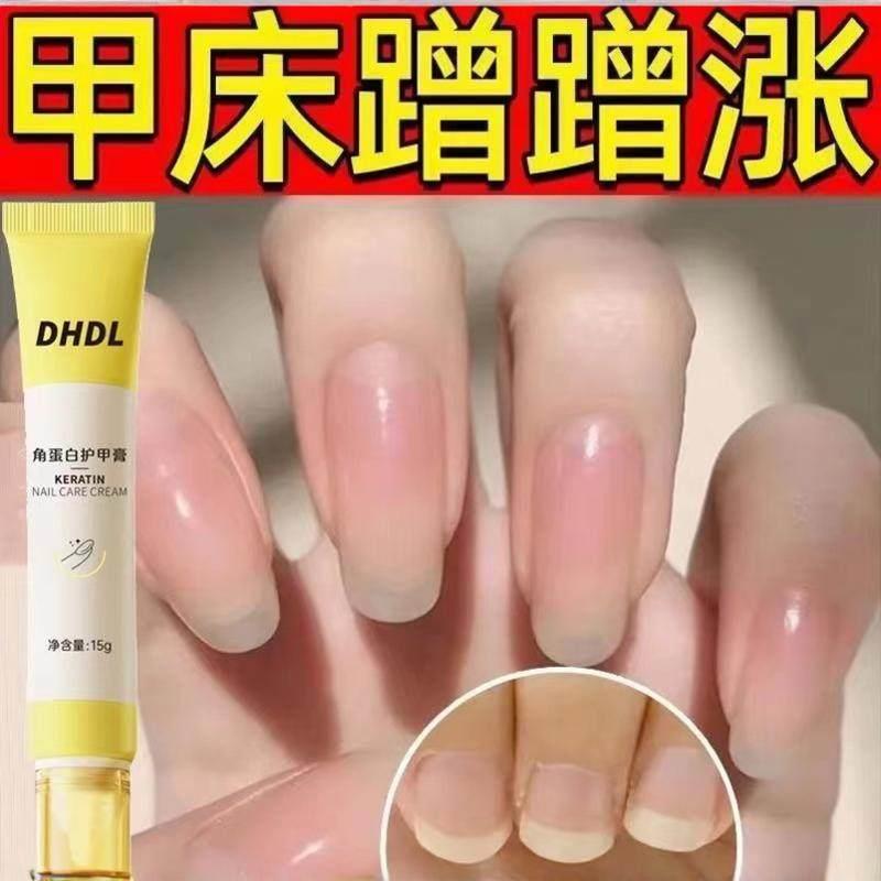 Student Party Recommends Nail Care Nutrient Oil to Promote Nail Bed Growth, Protect Nails, Nail Edge Oil, Nail Growth Liquid