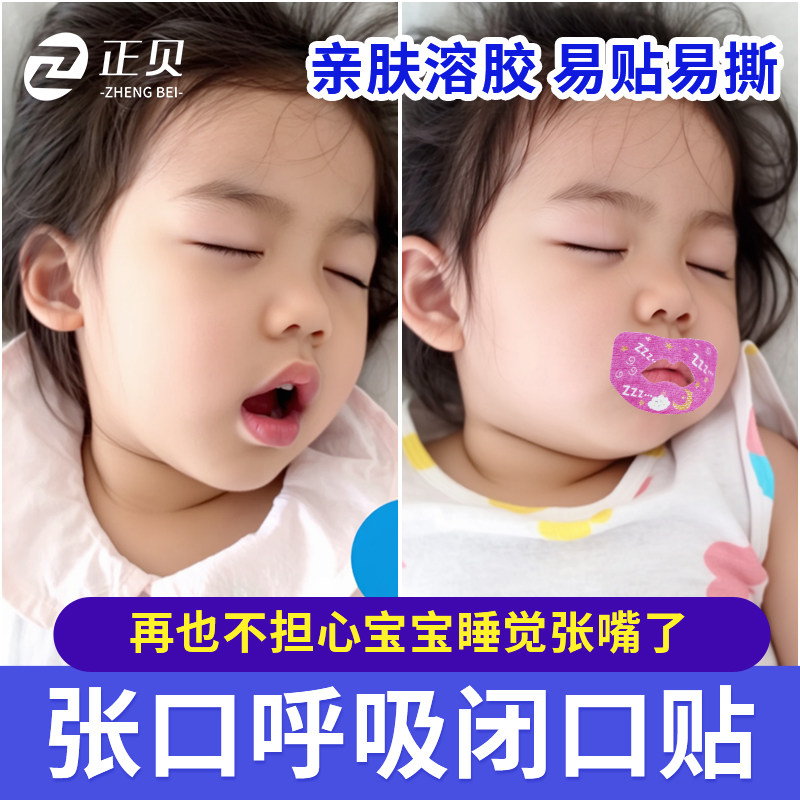 口呼吸矫正贴儿童睡觉防张嘴封嘴巴贴防打呼噜止鼾闭嘴神器成人