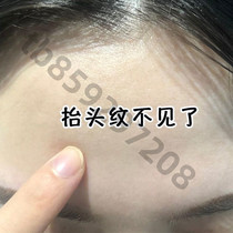 (Recently very popular) Anti-wrinkle small iron Say goodbye to forehead wrinkles and say goodbye to Sichuan pattern. It is suitable for both men and women~