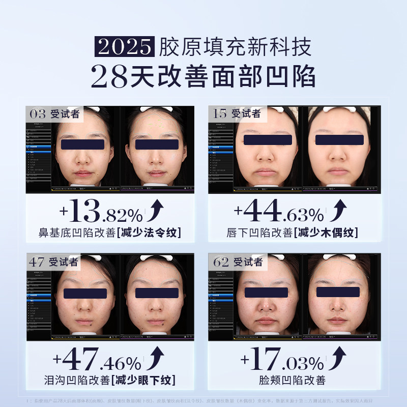 【双旦大促直降550】GEMO金茉4R胶原机家用抗衰胶原炮面部美容仪 3