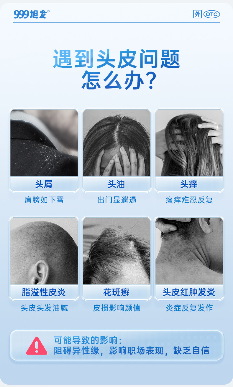 999 二硫化硒洗劑 脂漏性皮膚炎 去頭皮屑 毛囊炎洗髮精 止癢 花斑 汗癬 150g*1瓶/盒