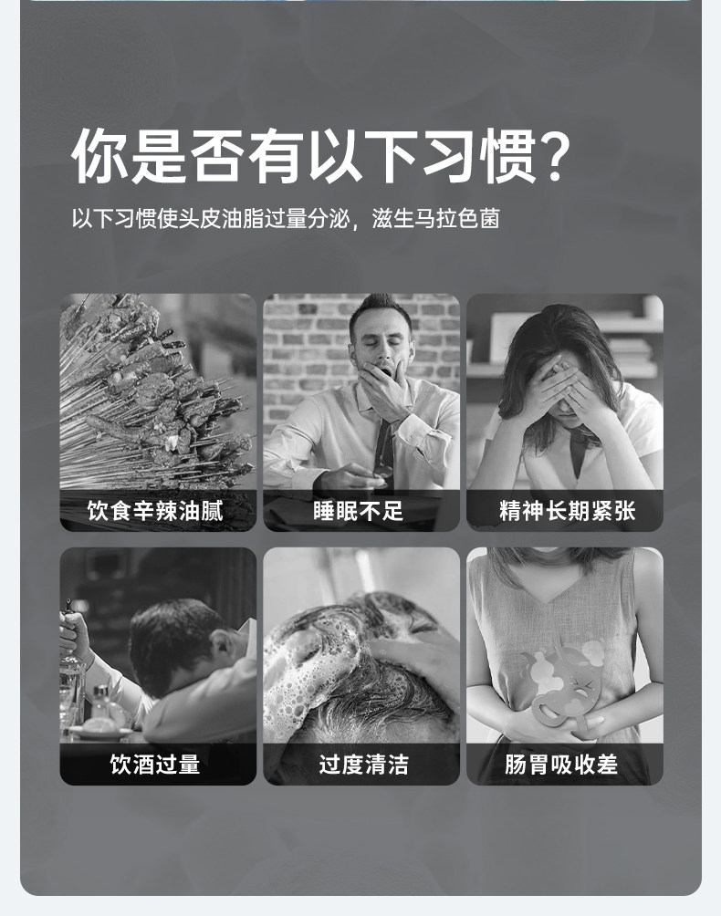 999 二硫化硒洗劑 脂漏性皮膚炎 去頭皮屑 毛囊炎洗髮精 止癢 花斑 汗癬 150g*1瓶/盒