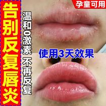 Lipstick special lipstick to repair lip crack with peeling lip corner skin crack to dry the lip mouth