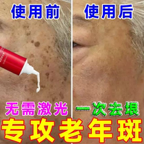 Discover freckle old spots powerfully remove dedicated hand-arm freckle brown melanin potion