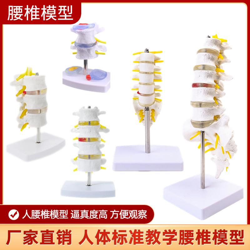 人体脊柱模型脊椎骨腰椎模型 腰椎结构腰椎间盘 关节模具病理腰椎