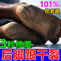 Cracked heel repair cream hands and feet cracked dead skin artifact heel care chapped ointment artifact ointment