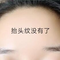 Best selling forehead wrinkle savior Sichuan pattern forehead anti-wrinkle artifact unisex buy 2 get 1 free