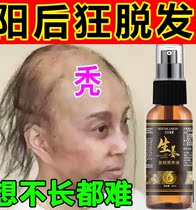 Yanghou total hair loss (baldness savior) hair growth liquid baldness hair growth agent thick hair hair growth liquid prevents hair loss