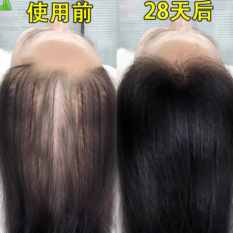 (short I eat) hair natural growth speed between men and women hair speed Mie-Taobao