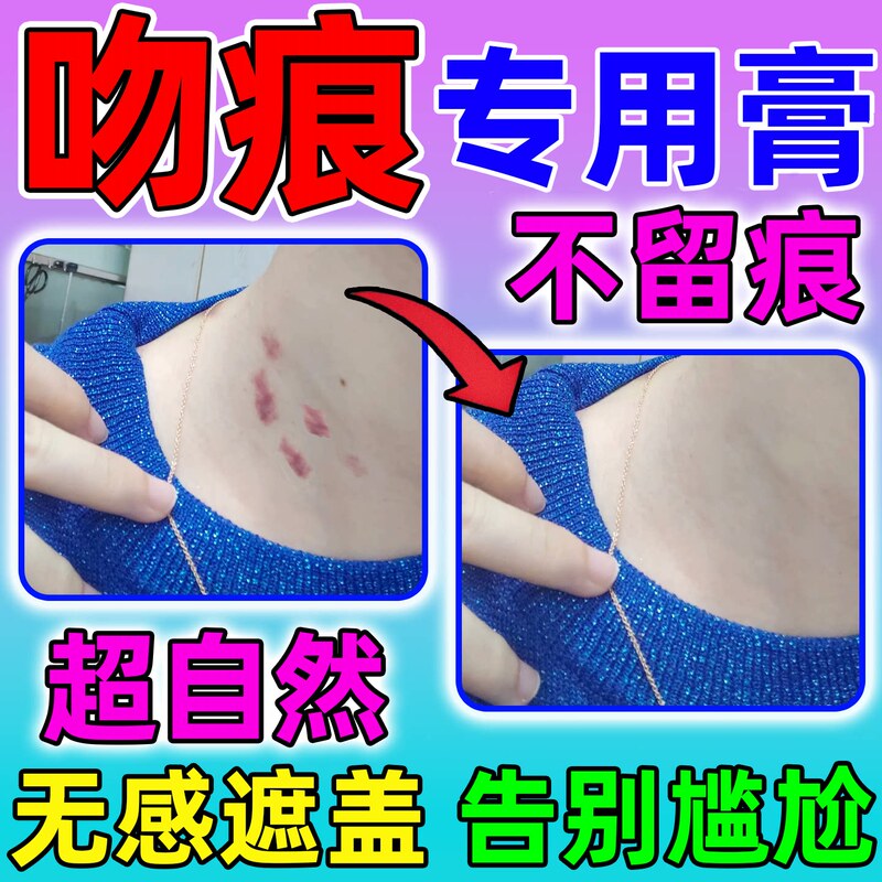 Scar Cover-Up for Kissing Marks, Strawberry Marks, and Birthmarks on the Neck; Invisible Tattoo Concealer; Specialized Scar Concealer