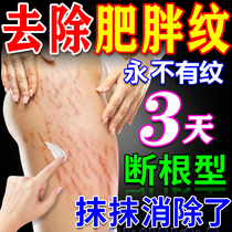 Remove obesity lines repair growth lines with essential oil eliminate growth lines on thighs remove lines for men fade lines remove obesity lines repair