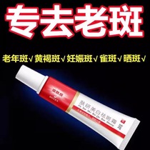 Spot removal cream specializes in removing age spots special face removal ointment for hands and back of hands powerful removal