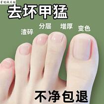 uj Tong Ren Tang Hot Sale (Grow New Nails in Seven Days) One drop of it can turn bad nails into good ones grow new nails inhibit bacteria and not remove them