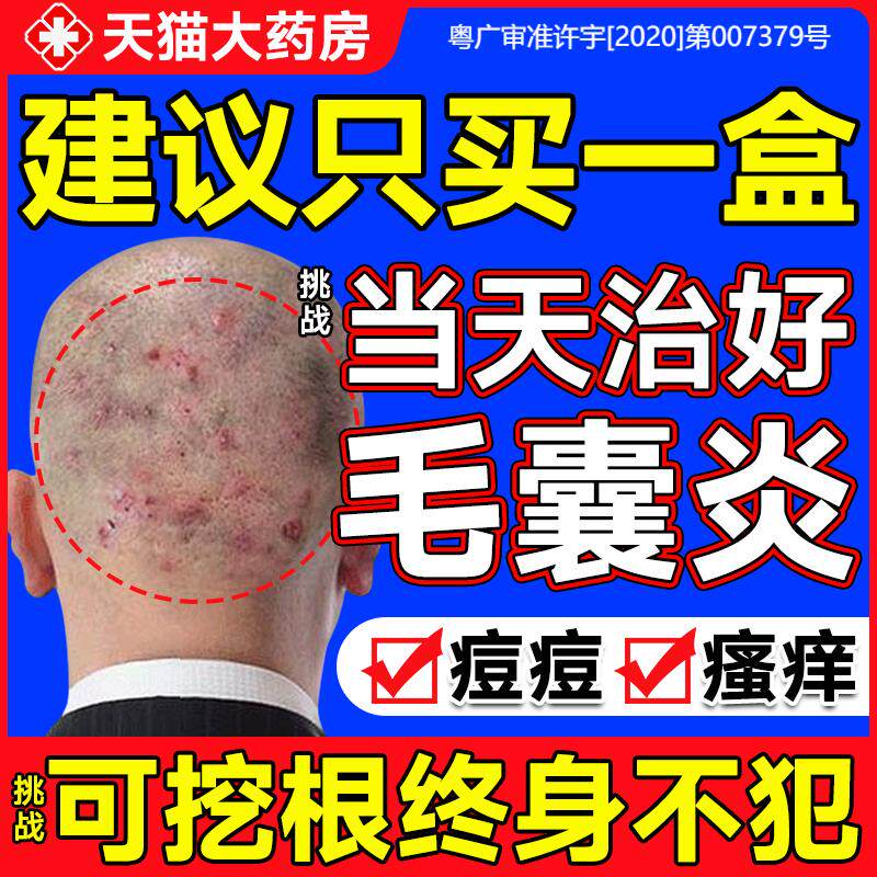 头皮毛囊炎&脂溢性皮炎,这些专业药膏帮你摆脱“头”等大事-皮脂汗腺-淘宝好物网