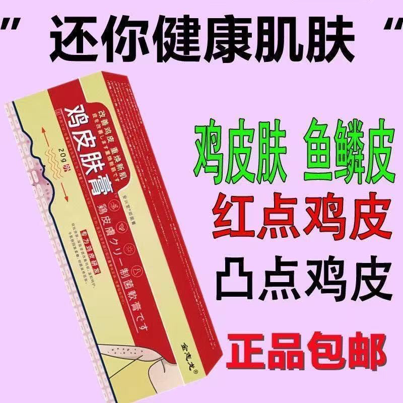 去鸡皮肤膏正品美白腿部鱼鳞皮肤霜干燥手去鸡皮疙瘩脱皮角化神器
