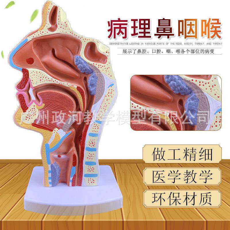 病态鼻咽喉模型医用鼻腔解剖呼吸道模型喉咙带肌肉血管神经甲状腺