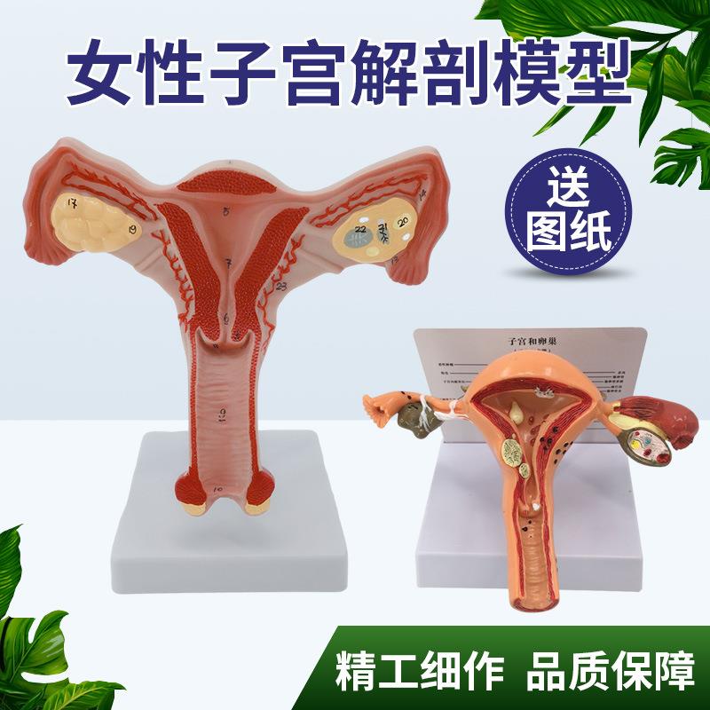 人体女性生殖子宫解剖病理模型 阴道卵巢教学模型 妇科生殖科教具