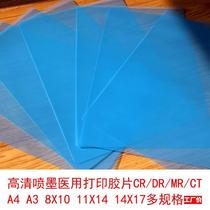 X-ray film CJL blue-based inkjet medical film RDR printing C tooth 8*10 orthopedic radiography dry glue A4