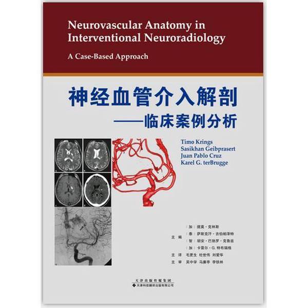 Authentic Books | Neurovascular Interventional Anatomy—Clinical Case Analysis (Canada) Timo Klings, (Thailand) Sasakh Khan Giberpazet, (Chile) Juan Pablo Cruz Authentic Books | Neurovascular Interventional Anatomy—Clinical Case Analysis (Canada) Timo Klings, (Thailand) Sasakh Khan Giberpazet, (Chile) Juan Pablo Cruz