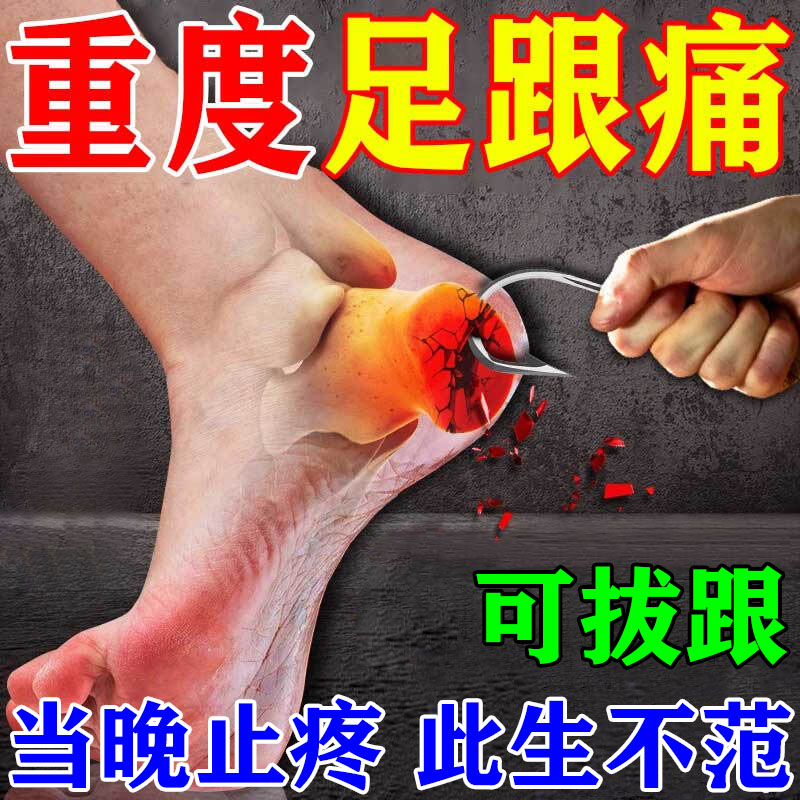 (100% Metallurgical) heel pain plantar heel Tendinitis Bone Thorn reflexology Heel Ligament with Heel Pain Special Medicine Sticker-Taobao