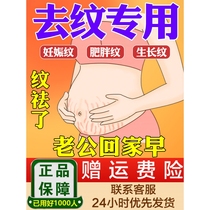Specialized stretch mark removal oil postpartum repair cream prevention of growth marks for pregnant women obesity mark reduction firming removal and elimination