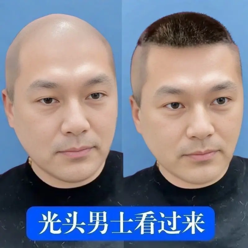 Men's Hair, Bald Head, Short Hair, Male Full Real Hair Guo Degang Hairstyle, Scalp Full Real Wig Piece, Men's Wig Same Style