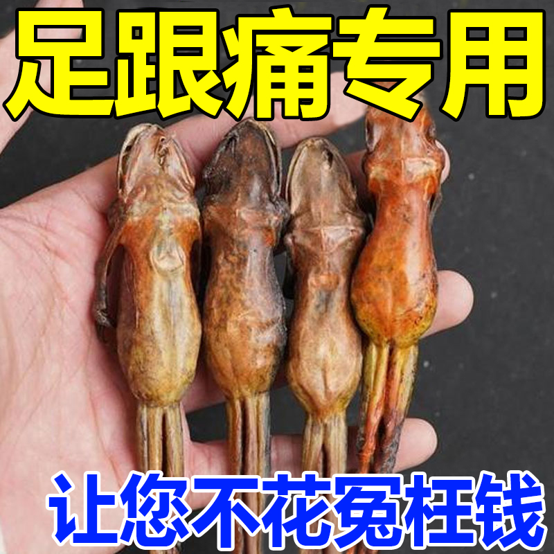 Heel pain (used by ten thousand people) heel pain heel tendon reflexology ligaments with lacerate heel pain special post-Taobao
