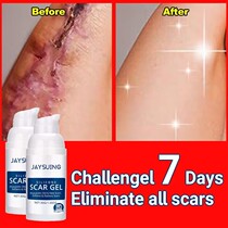2Pcs Scar Removal Cream Burn Surgical Scar Shark Stch Marks