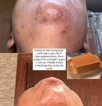 Jabón de cúrcuma con extracto de cúrcuma REAL para aclara