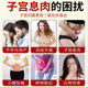 ຢາປົວພະຍາດ endometrial polyp thinning and thickening conditioning endometriosis sagging cervical cyst hypertrophy Warm Gongshu patch