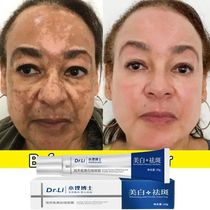 Effective Whitening Freckles Cream Remove Melasma Dark Spots