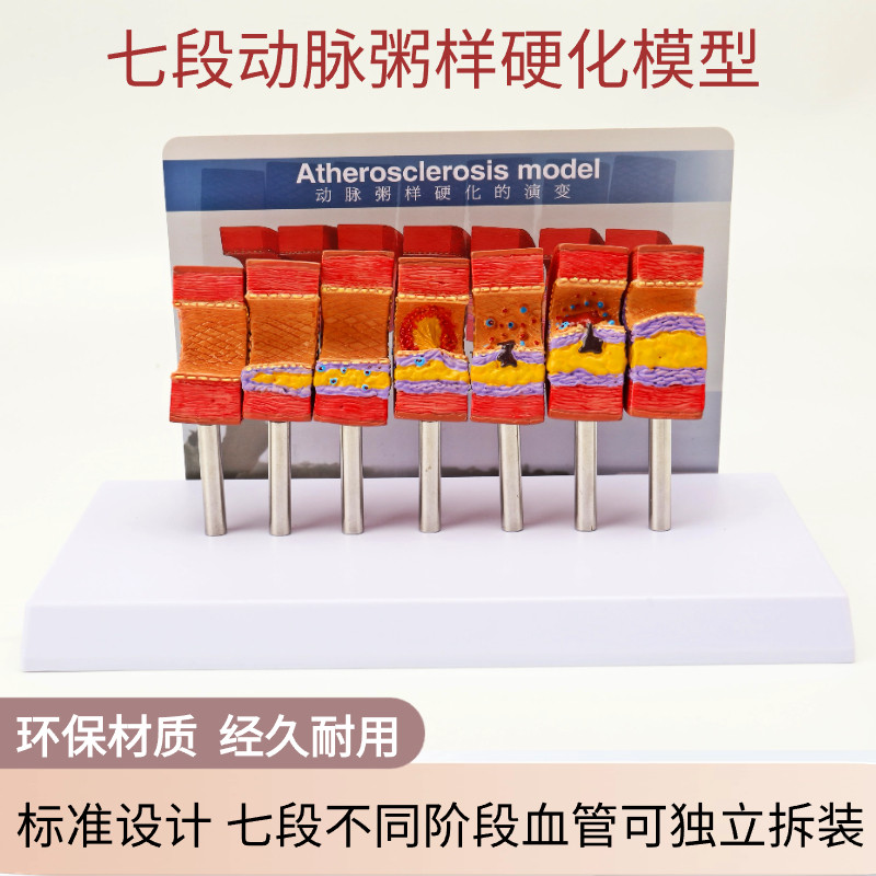 动脉粥样硬化模型血管血栓栓塞模型动脉血管人体医用医学教学模型
