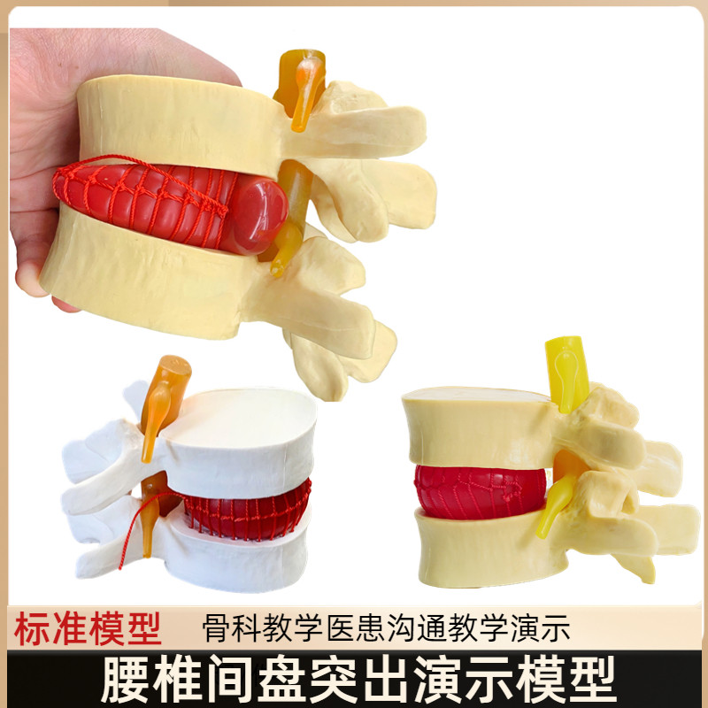 人体脊柱模型脊椎骨头腰椎间盘模具椎体模型突出受压病理骨质教具
