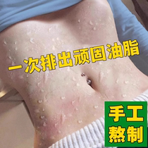 (Xiaohongshu is super popular buy 3 and get 2 free) Beauty salon herbal mud moxibustion say goodbye to wetness and fat it can be used all over the body
